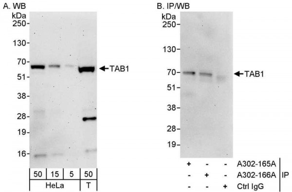 Anti-TAB1