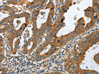Anti-COL1A2