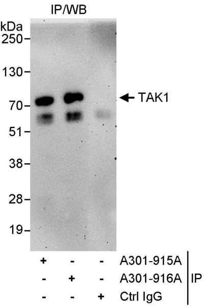 Anti-TAK1