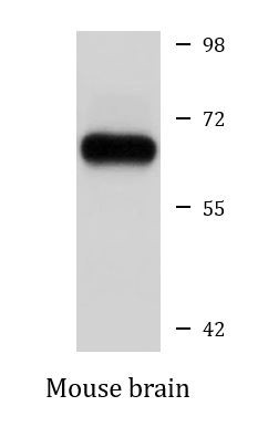 Anti-CCT8 / TCP1 theta