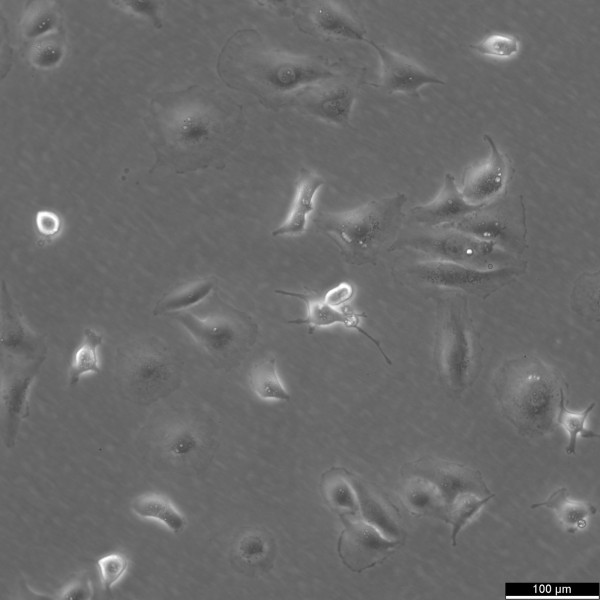 FTC-133 Cells