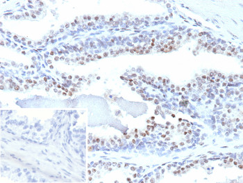 Anti-ERG / ETS transcription factor ERG, clone ERG1/12589