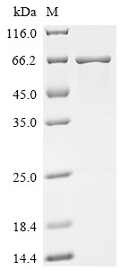 Carboxylesterase 3 (CES3), human, recombinant