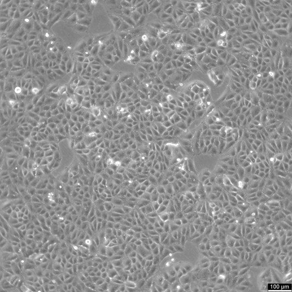 SNU-878 Cells