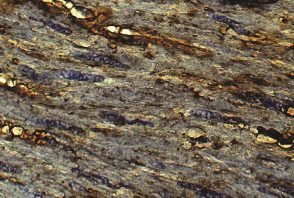 Anti-Collagen VI