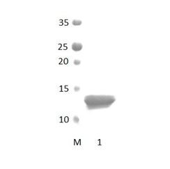 HTRA2 PDZ Domain