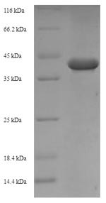 Allergen Ara h 1, clone P17,partial, Arachis hypogaea, recombinant