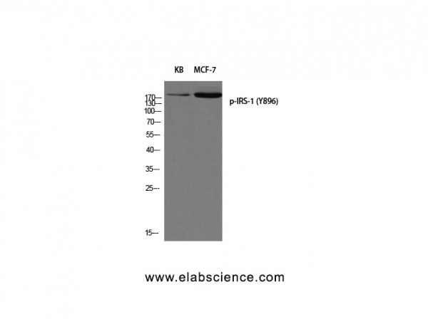 Anti-Phospho-IRS-1 (Tyr896)