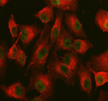 Anti-NCOA6 / Nuclear receptor coactivator 6