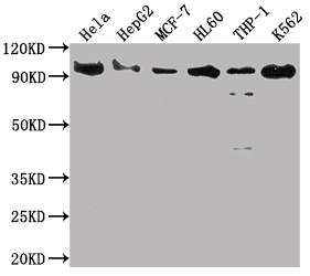 Anti-SUZ12 Recombinant Monoclonal, clone 1B10