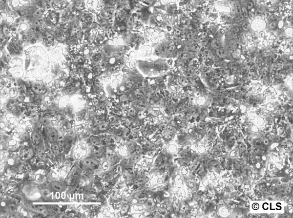 Colo-94H Cells