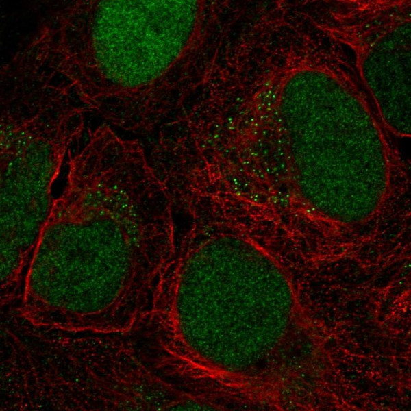 Anti-CTDP1