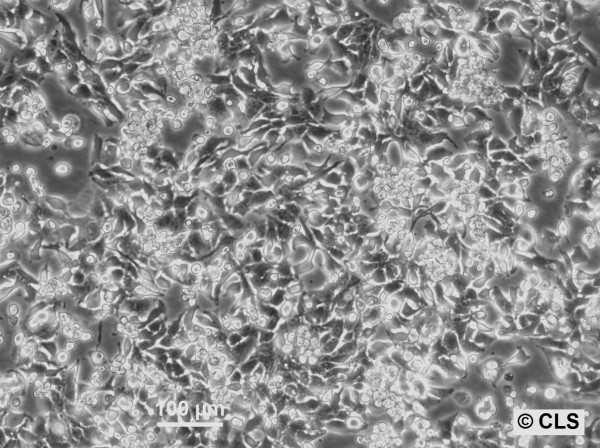 RT-112-D21 Cells