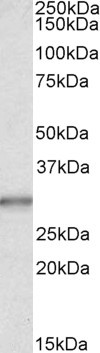 Anti-CA1, Internal