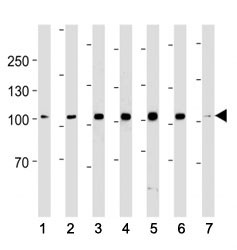 Anti-ACE2, clone 881CT16.4.4