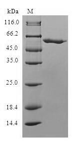 Mitochondrial carnitine/acylcarnitine carrier protein (SLC25A20), human, recombinant