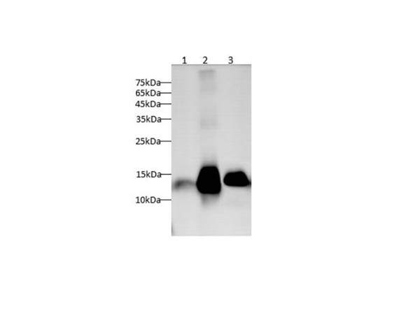 GAL7 Polyclonal antibody