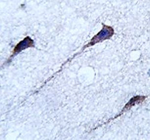 Anti-PUM1 / Pumilio 1