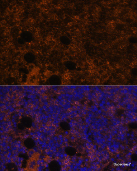 Anti-CD11b