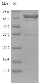 Lysyl oxidase homolog 4 (LOXL4), human, recombinant