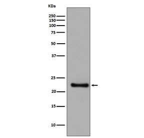 Anti-GPX1 / Glutathione Peroxidase 1, clone IIF-7