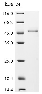 Fructose-bisphosphate aldolase C (Aldoc), mouse, recombinant