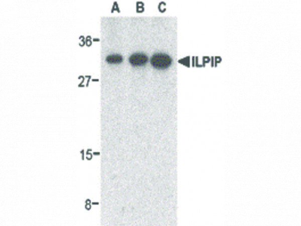 Anti-ILPIP