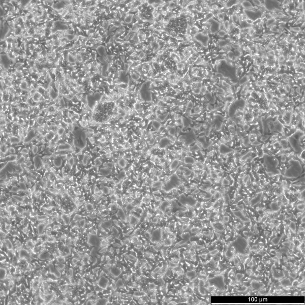 SK-N-BE(2) Cells