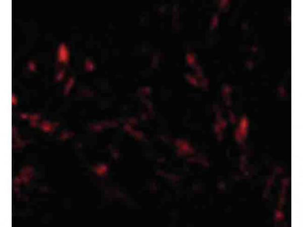 Anti-TTC5
