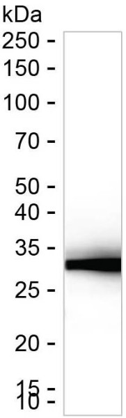Anti-Sulfotransferase 2A1