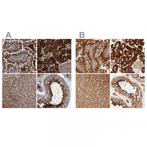 Anti-PCYT2