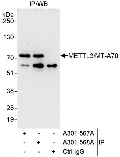 Anti-METTL3/MT-A70