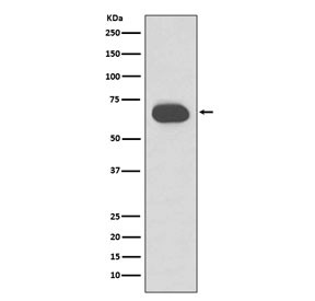 Anti-Keratin 1, clone GBH-11