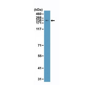 Anti-Topoisomerase II alpha / TOP2A, clone RM394