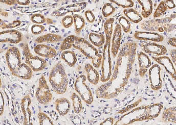Anti-I-TAC/CXCL11 Monoclonal Antibody