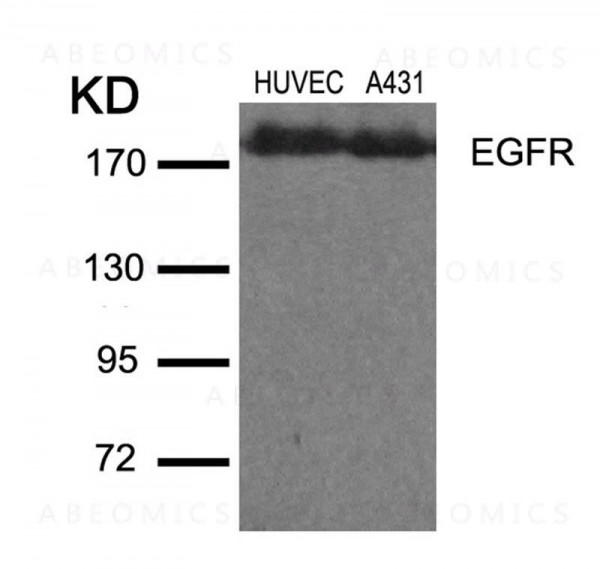 Anti-EGFR (Ab-1110)