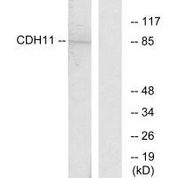 Anti-CDH11