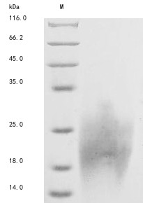Homeobox protein Hox-A2 (HOXA2), partial, human, recombinant