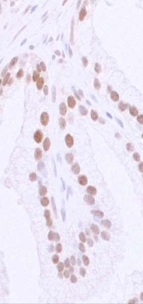 Anti-53BP1 (IHC)