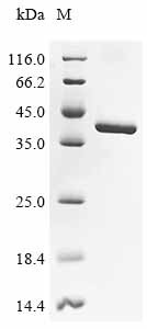 Lys-63-specific deubiquitinase BRCC36 (Brcc3), mouse, recombinant