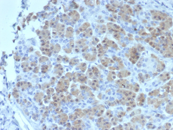 Anti-BRCA2 (Breast Marker), clone BRCA2/2158