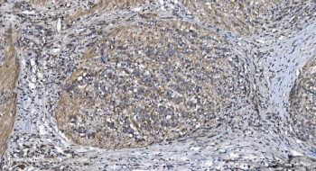 Anti-STIL / SIL / SCL-interrupting locus protein