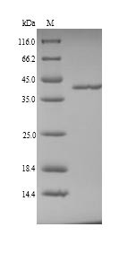 Coagulation factor XII (F12), partial, swine, recombinant