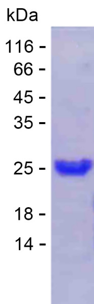 Recombinant Human BSCL2 Protein