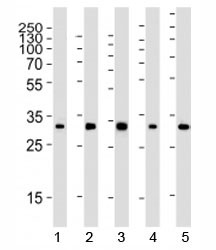 Anti-RPS6, clone 981CT2.1.1