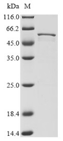 Nucleoprotein (N), human coronavirus NL63, recombinant