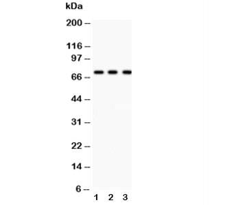 Anti-p73