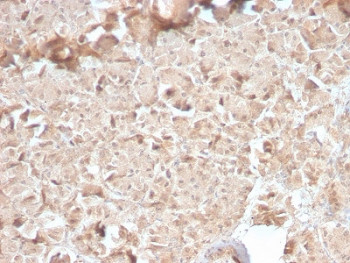 Anti-CELA3B / Elastase 3B, clone CELA3B/2810R