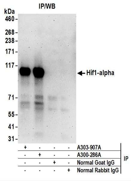 Anti-HIF1-alpha