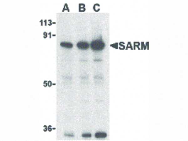 Anti-SARM